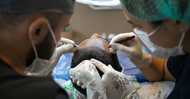 Er prisen på en hårtransplantation det værd? En analyse af omkostningerne og fordelene
